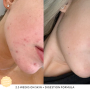 JShealth 60's Skin + Digeston Vitamins