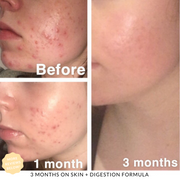 JShealth 60's Skin + Digeston Vitamins