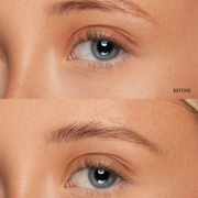 Close-up of a person's eye with 'Before' and 'After' comparison on skin texture.