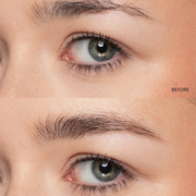 Close-up of a person's eyes with 'BEFORE' label on a beige background